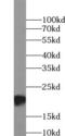 Proteasome Subunit Beta 9 antibody, FNab04810, FineTest, Western Blot image 