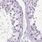 Breast Carcinoma Amplified Sequence 1 antibody, NBP2-38658, Novus Biologicals, Immunohistochemistry paraffin image 