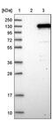 Zinc Finger CCCH-Type Containing 11A antibody, PA5-55877, Invitrogen Antibodies, Western Blot image 