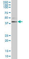 Ring Finger Protein 1 antibody, LS-C139487, Lifespan Biosciences, Western Blot image 