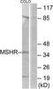 Melanocortin 1 Receptor antibody, TA311992, Origene, Western Blot image 