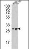 BCL2 Like 11 antibody, A01552-3, Boster Biological Technology, Western Blot image 