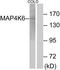 Misshapen Like Kinase 1 antibody, TA315416, Origene, Western Blot image 