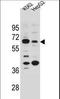 Solute Carrier Family 9 Member B1 antibody, LS-C164867, Lifespan Biosciences, Western Blot image 