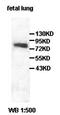 Acyl-CoA Dehydrogenase Family Member 11 antibody, orb77704, Biorbyt, Western Blot image 