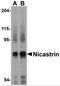 Nicastrin antibody, 3985, ProSci Inc, Western Blot image 