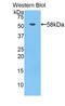 Bruton Tyrosine Kinase antibody, LS-C293066, Lifespan Biosciences, Western Blot image 