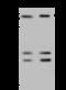 RNA Polymerase III Subunit E antibody, 203815-T36, Sino Biological, Western Blot image 