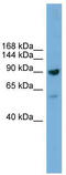 DEAD-Box Helicase 54 antibody, TA329947, Origene, Western Blot image 