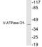 ATPase H+ Transporting V0 Subunit D1 antibody, LS-C200048, Lifespan Biosciences, Western Blot image 