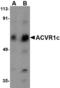 Activin A Receptor Type 1 antibody, LS-B3109, Lifespan Biosciences, Western Blot image 