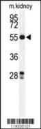 Galactosamine (N-Acetyl)-6-Sulfatase antibody, LS-B11686, Lifespan Biosciences, Western Blot image 
