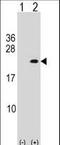 Phospholipase A2 Group XIIA antibody, LS-C163755, Lifespan Biosciences, Western Blot image 