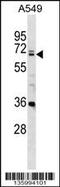 DEAD-Box Helicase 28 antibody, 58-493, ProSci, Western Blot image 