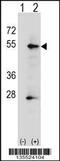 Alkaline Phosphatase, Placental antibody, 58-109, ProSci, Western Blot image 