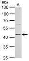 ERCC Excision Repair 8, CSA Ubiquitin Ligase Complex Subunit antibody, TA308521, Origene, Western Blot image 