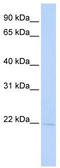 Retention In Endoplasmic Reticulum Sorting Receptor 1 antibody, TA341877, Origene, Western Blot image 