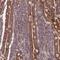 Solute Carrier Family 35 Member B4 antibody, NBP2-13329, Novus Biologicals, Immunohistochemistry paraffin image 