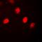 Progesterone Receptor antibody, orb315652, Biorbyt, Immunofluorescence image 
