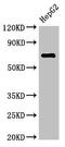 ST6 N-Acetylgalactosaminide Alpha-2,6-Sialyltransferase 1 antibody, CSB-PA868312LA01HU, Cusabio, Western Blot image 