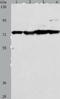 Matrix Metallopeptidase 15 antibody, TA321486, Origene, Western Blot image 