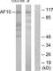 Protein AF-10 antibody, TA314714, Origene, Western Blot image 