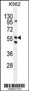Leucine Rich Repeat, Ig-Like And Transmembrane Domains 1 antibody, 55-832, ProSci, Western Blot image 