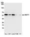 Succinyl-CoA:3-ketoacid-coenzyme A transferase 1, mitochondrial antibody, A305-541A, Bethyl Labs, Western Blot image 