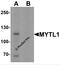 Myelin transcription factor 1-like protein antibody, 7083, ProSci, Western Blot image 