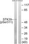Serine/Threonine Kinase 39 antibody, abx012629, Abbexa, Western Blot image 