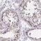 Zinc Finger Protein 778 antibody, NBP2-33817, Novus Biologicals, Immunohistochemistry frozen image 