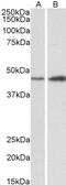 UDP-glucuronosyltransferase 2B2 antibody, 42-431, ProSci, Western Blot image 