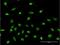 40S ribosomal protein S2 antibody, H00006187-M05, Novus Biologicals, Immunocytochemistry image 