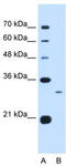 Complement C1q subcomponent subunit B antibody, TA335243, Origene, Western Blot image 