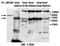 ATP Binding Cassette Subfamily G Member 1 antibody, orb77519, Biorbyt, Western Blot image 