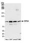 Protein CIP2A antibody, A500-010A, Bethyl Labs, Western Blot image 