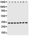 Enoyl-CoA Delta Isomerase 1 antibody, PA1763, Boster Biological Technology, Western Blot image 