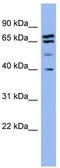 SH3 Domain Containing GRB2 Like 2, Endophilin A1 antibody, TA342208, Origene, Western Blot image 