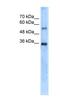 Carbonic Anhydrase 8 antibody, NBP1-54947, Novus Biologicals, Western Blot image 