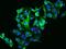 ADH4 antibody, 204657-T02, Sino Biological, Immunohistochemistry frozen image 