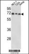 Abl Interactor 1 antibody, TA325043, Origene, Western Blot image 