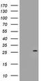 N-Ribosyldihydronicotinamide:Quinone Reductase 2 antibody, TA504780, Origene, Western Blot image 