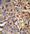 Hydroxysteroid 17-Beta Dehydrogenase 12 antibody, LS-C165033, Lifespan Biosciences, Immunohistochemistry paraffin image 