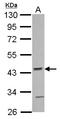 Actin Related Protein 10 antibody, LS-C155692, Lifespan Biosciences, Western Blot image 