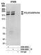 RNA Polymerase I Subunit A antibody, A304-845A, Bethyl Labs, Immunoprecipitation image 
