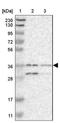 Cytochrome b-561 antibody, NBP1-83422, Novus Biologicals, Western Blot image 
