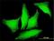 Polycystin 2, Transient Receptor Potential Cation Channel antibody, H00005311-M01, Novus Biologicals, Immunofluorescence image 