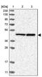 Ribosome Production Factor 1 Homolog antibody, PA5-55136, Invitrogen Antibodies, Western Blot image 