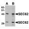 SEC62 Homolog, Preprotein Translocation Factor antibody, MBS150395, MyBioSource, Western Blot image 