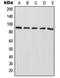 RAS P21 Protein Activator 4 antibody, LS-C353227, Lifespan Biosciences, Western Blot image 